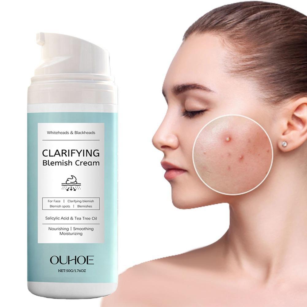 Salicylic Acid Blackhead Remover - Creme Removedor de Acne com Ácido